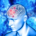 vascular brain diseases, vascular brain diseases treatment in indore, brain disease treatment in indore, brain surgery in indore