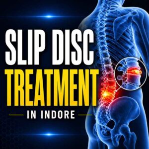 Slip disc treatment in Indore showing spine disc problem and expert care by Dr Ashish Kumar Dwivedi