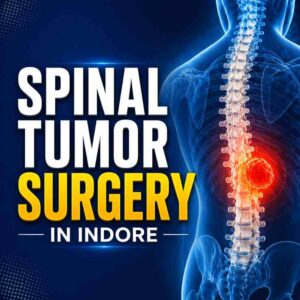 Spinal tumor surgery in Indore showing spine with tumor highlight, advanced spine treatment by Dr Ashish Kumar Dwivedi