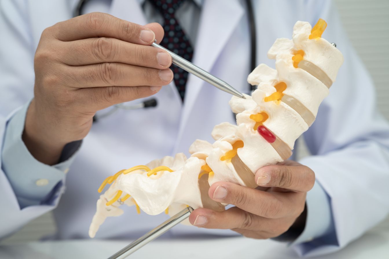 Sciatica treatment in Indore by experienced specialist for effective pain relief and improved mobility.
