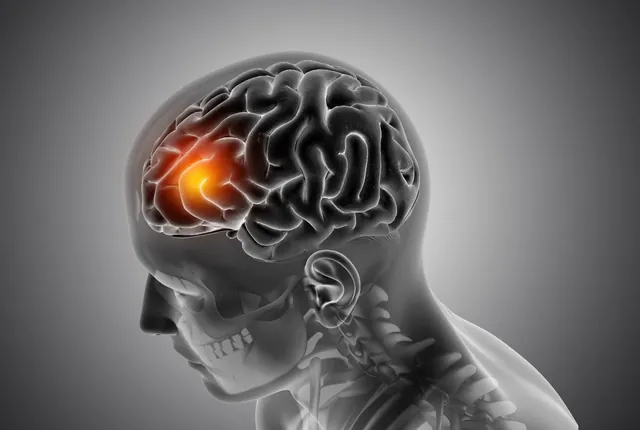 Neuro-navigation imaging